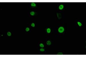 Immunofluorescence staining of MCF-7 cells with ABIN7172475 at 1:100, counter-stained with DAPI. (TFAP2C antibody  (AA 8-180))