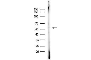 anti-PBX/knotted 1 Homeobox 2 (PKNOX2) (C-Term) antibody