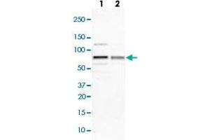 Western blot analysis of Lane 1: NIH-3T3 cell lysate (Mouse embryonic fibroblast cells); Lane 2: NBT-II cell lysate (Rat Wistar bladder tumour cells) with IGF2BP3 polyclonal antibody  at 1:100-1:250 dilution.