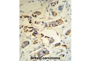Immunohistochemistry (IHC) image for anti-Complement Component 1, Q Subcomponent, A Chain (C1QA) antibody (ABIN3003141) (C1QA antibody)