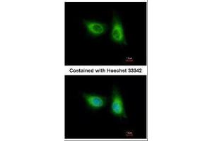 ICC/IF Image Immunofluorescence analysis of methanol-fixed A549, using SOS2, antibody at 1:500 dilution. (SOS2 antibody  (Center))
