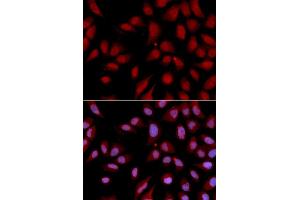 Immunofluorescence analysis of U2OS cell using DLGAP5 antibody.