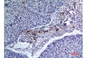 Immunohistochemistry (IHC) analysis of paraffin-embedded Human Lung, antibody was diluted at 1:100. (IREM1 antibody  (Internal Region))