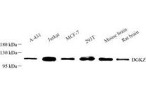 Western blot analysis of Dgkz (ABIN7073722),at dilution of 1: 1500 (DGKZ antibody)