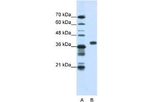 WB Suggested Anti-PCBP1 Antibody Titration:  1. (PCBP1 antibody  (Middle Region))