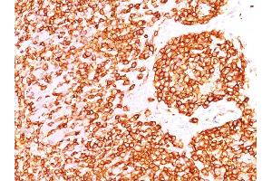 Formalin-fixed, paraffin-embedded human Tonsil stained with CD45 Mouse Recombinant Monoclonal Antibody (rPTPRC/1460). (Recombinant CD45 antibody)