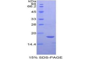 SDS-PAGE (SDS) image for Bone Morphogenetic Protein 6 (BMP6) (AA 375-513) protein (His tag) (ABIN1078993)