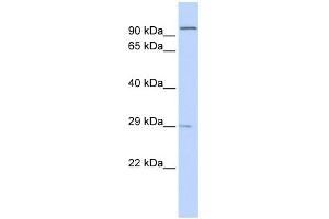 WB Suggested Anti-SSPN Antibody Titration:  0. (SSPN antibody  (Middle Region))