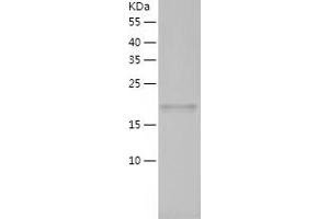 ARL2 Protein (AA 1-184) (His tag)
