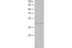 Western Blotting (WB) image for ADP-Ribosylation Factor-Like 2 (ARL2) (AA 1-184) protein (His tag) (ABIN7286038) (ARL2 Protein (AA 1-184) (His tag))