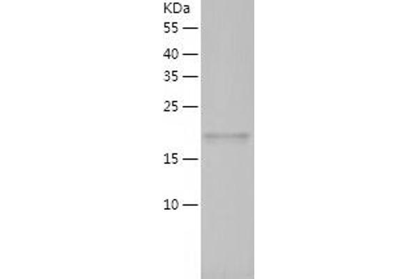 ARL2 Protein (AA 1-184) (His tag)