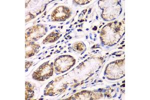Immunohistochemistry of paraffin-embedded human colon using RPN1 antibody.