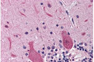 Human Brain, Cerebellum (formalin-fixed, paraffin-embedded) stained with RRM2B antibody ABIN214469 at 2. (RRM2B antibody  (AA 2-17))