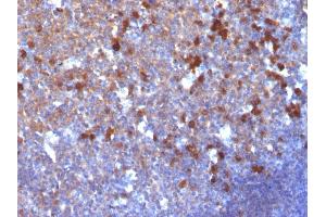 Formalin-fixed, paraffin-embedded human Tonsil stained with IgG Monoclonal Antibody (IG217) (IGHG antibody)