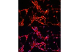 Immunofluorescence analysis of NIH/3T3 cells using GSK3α antibody (ABIN1680131, ABIN3015275, ABIN3015276 and ABIN6213918) at dilution of 1:100. (GSK3 alpha antibody  (AA 409-483))