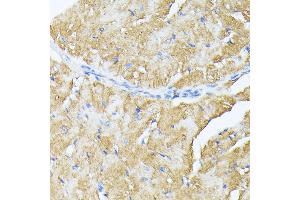 Immunohistochemistry of paraffin-embedded mouse heart using TP53I11 antibody (ABIN6131365, ABIN6149418, ABIN6149419 and ABIN6216636) at dilution of 1:100 (40x lens). (TP53I11 antibody  (AA 1-70))