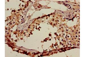 Immunohistochemistry of paraffin-embedded human testis tissue using ABIN7143025 at dilution of 1:100 (ACRV1 antibody  (AA 22-265))