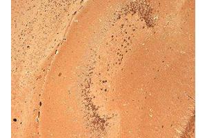 GluR2 Immunohistochemistry. (GRIA2 antibody  (C-Term))