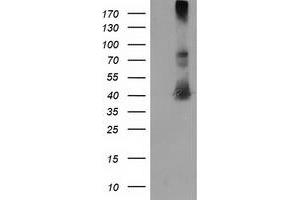 HEK293T cells were transfected with the pCMV6-ENTRY control (Left lane) or pCMV6-ENTRY MAPRE2 (Right lane) cDNA for 48 hrs and lysed. (MAPRE2 antibody)