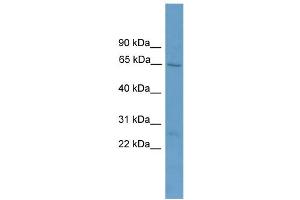 WB Suggested Anti-ACOT11  Antibody Titration: 0. (ACOT11 antibody  (Middle Region))