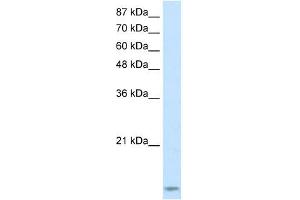 TARBP2 antibody used at 2. (TARBP2 antibody)