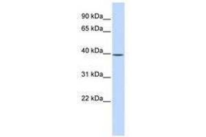 Image no. 1 for anti-Methionine Adenosyltransferase II, beta (MAT2B) (AA 35-84) antibody (ABIN6741382) (MAT2B antibody  (AA 35-84))