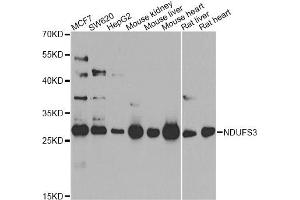 Western blot analysis of extracts of various cell lines, using NDUFS3 antibody (ABIN5974479) at 1/1000 dilution.