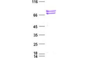 Validation with Western Blot