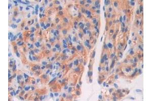 Detection of F5 in Mouse Ovary Tissue using Polyclonal Antibody to Coagulation Factor V (F5) (Coagulation Factor V antibody  (AA 364-611))