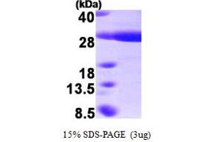 SDS-PAGE (SDS) image for Heat Shock 22kDa Protein 8 (HSPB8) (AA 1-196) protein (His tag) (ABIN667769)