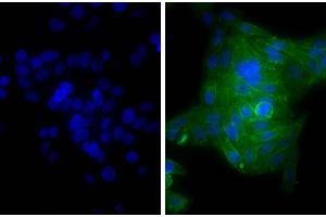 Human epithelial carcinoma cell line HEp-2 was stained with Mouse Anti-Human CD44-UNLB and DAPI.