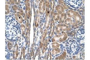 FAM55D antibody was used for immunohistochemistry at a concentration of 4-8 ug/ml to stain Epithelial cells of renal tubule (arrows) in Human Kidney. (FAM55D antibody  (C-Term))