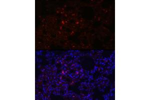 Immunofluorescence analysis of rat lung using SFTPC Rabbit pAb (ABIN3015597, ABIN3015598, ABIN3015599, ABIN1682683 and ABIN6218961) at dilution of 1:100 (40x lens). (Surfactant Protein C antibody  (AA 1-197))