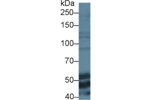Detection of ELN in Mouse Liver lysate using Polyclonal Antibody to Elastin (ELN) (Elastin antibody  (AA 266-443))