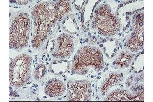 Image no. 1 for anti-Regulatory Factor X-Associated Ankyrin Containing Protein (RFXANK) antibody (ABIN1500685) (RFXANK antibody)