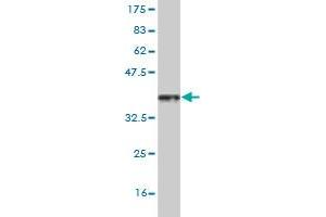 Western Blot detection against Immunogen (36. (HSF4 antibody  (AA 121-220))