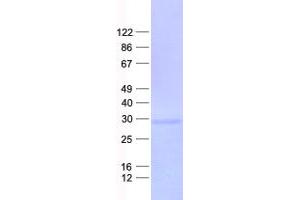THAP Domain Containing 6 (THAP6) protein (His tag)