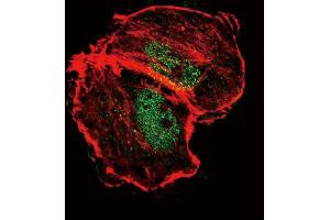 Confocal immunofluorescent analysis of Phospho-TSC2-p Antibody (ABIN389817 and ABIN2839703) with MCF-7 cell followed by Alexa Fluor 488-conjugated goat anti-rabbit lgG (green). (Tuberin antibody  (pSer664))