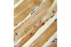Immunohistochemistry analysis in formalin fixed and paraffin embedded human skeletal muscle reacted with MLXIP Antibody (N-term) followed by peroxidase conjugation of the secondary antibody and DAB staining. (MLXIP antibody  (N-Term))
