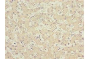 Immunohistochemistry of paraffin-embedded human liver tissue using ABIN7153515 at dilution of 1:100 (GABARAPL1 antibody  (AA 1-117))