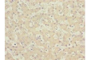 Immunohistochemistry of paraffin-embedded human liver tissue using ABIN7153515 at dilution of 1:100 (GABARAPL1 antibody  (AA 1-117))