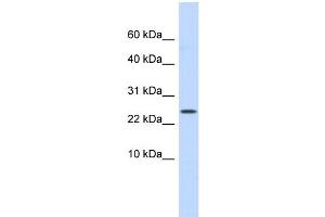WB Suggested Anti-LYPD6 Antibody Titration: 0. (LYPD6 antibody  (Middle Region))