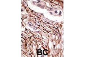 Immunohistochemistry (IHC) image for anti-Notch 3 (NOTCH3) antibody (ABIN3002554) (NOTCH3 antibody)