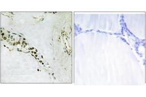 Immunohistochemistry analysis of paraffin-embedded human thyroid gland tissue, using Cyclin E2 (Ab-392) Antibody. (Cyclin E2 antibody  (AA 355-404))