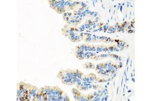 Immunohistochemistry of paraffin-embedded Mouse lung using RGS5 Polyclonal Antibody at dilution of 1:100 (40x lens). (RGS5 antibody)