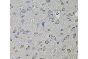 Immunohistochemistry of paraffin-embedded Rat brain using CKAP4 Polyclonal Antibody (CKAP4 antibody)