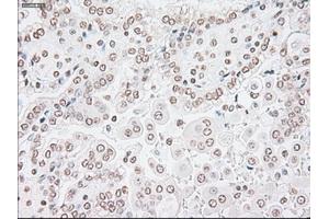 Image no. 2 for anti-Glial Fibrillary Acidic Protein (GFAP) antibody (ABIN1498440) (GFAP antibody)