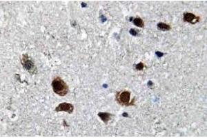Immunohistochemistry analysis of SCN2A Antibody in paraffin-embedded human brain tissue. (SCN2A antibody)