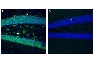 SLC7A2 antibody  (2nd Extracellular Loop)