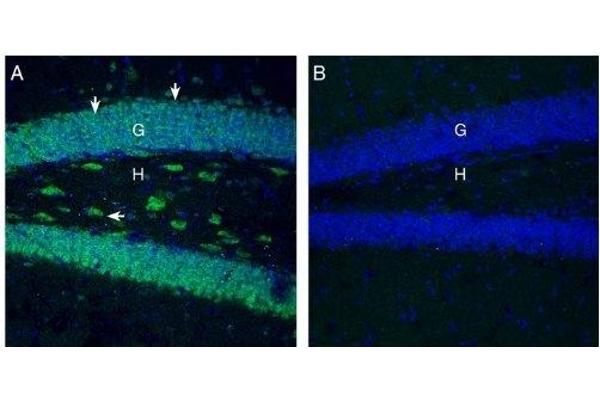 SLC7A2 antibody  (2nd Extracellular Loop)